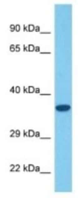 Olfactory receptor 484 Rabbit anti-Mouse, Polyclonal, Novus Biologicals 100 &mu;g | Buy Online | Novus Biologicals | Fisher Scientific